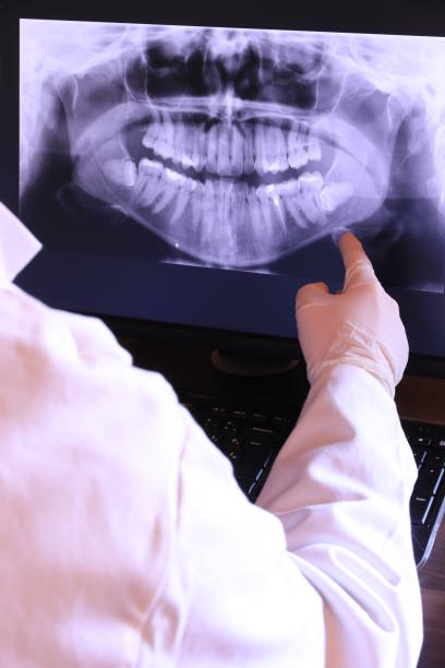 Best Emergency Wisdom Teeth Removal in Escondido, CA