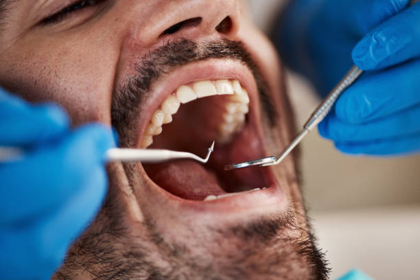 Best Cosmetic Emergency Dentistry in Escondido, CA