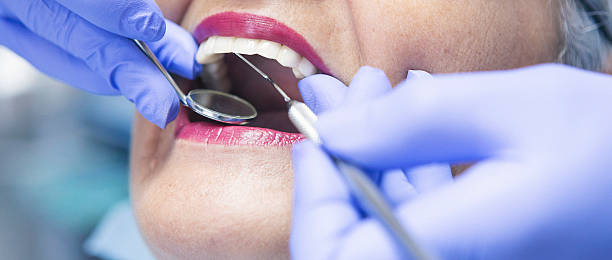 Best Emergency Gum Treatment in Escondido, CA